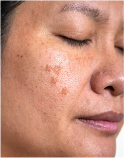 state of skin after usage