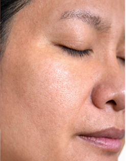 state of skin before usage
